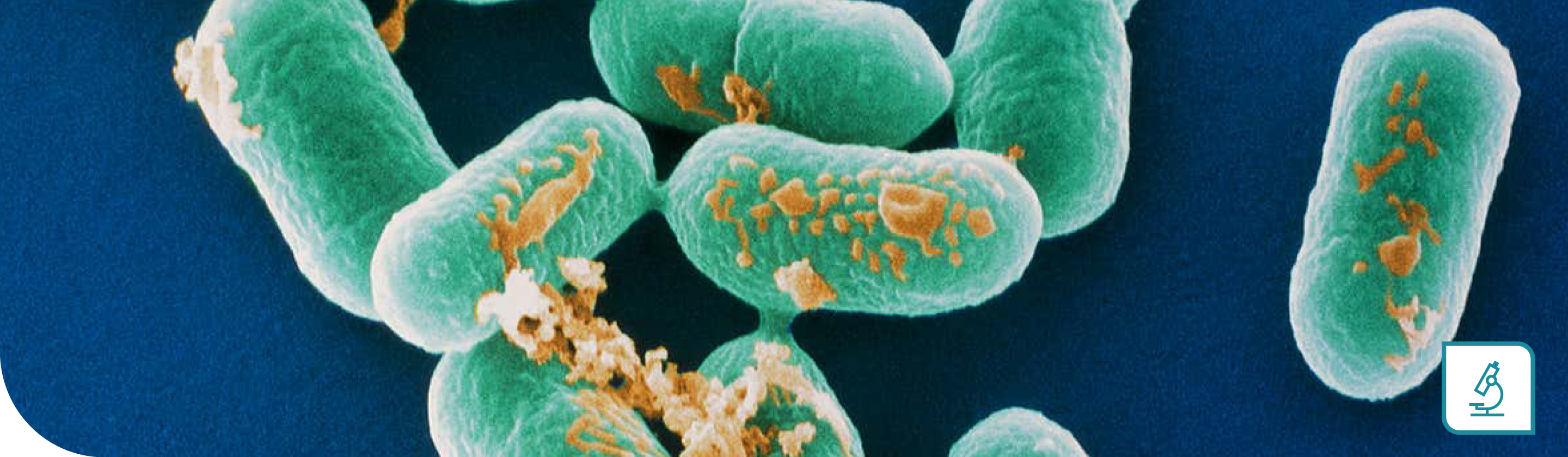 Servicios de identificación microbiana